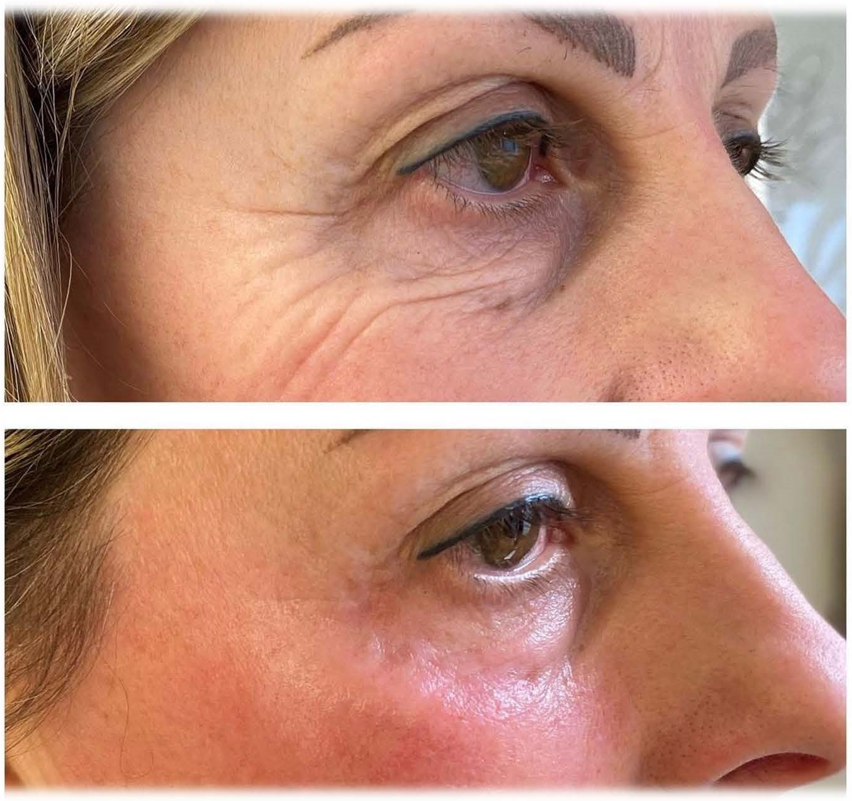 Semplici Desideri trattamento viso tesla med