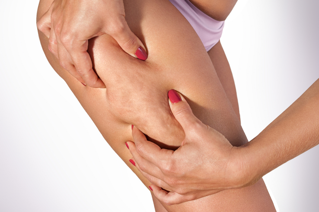 Massaggio per cellulite