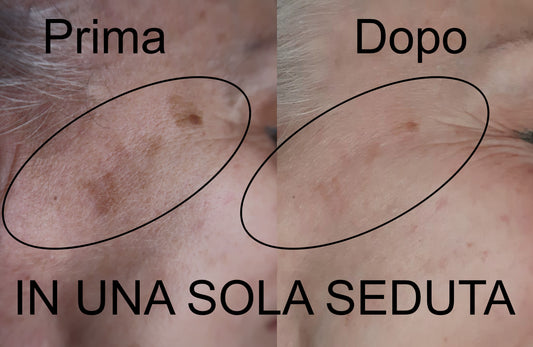 Semplici Desideri trattamento viso anti macchia