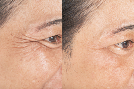 Semplici Desideri trattamento viso tesla med