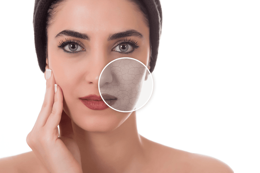 Semplici Desideri trattamento viso pelle secca