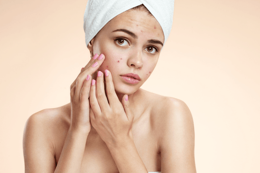 Semplici Desideri trattamento viso pelli giovani